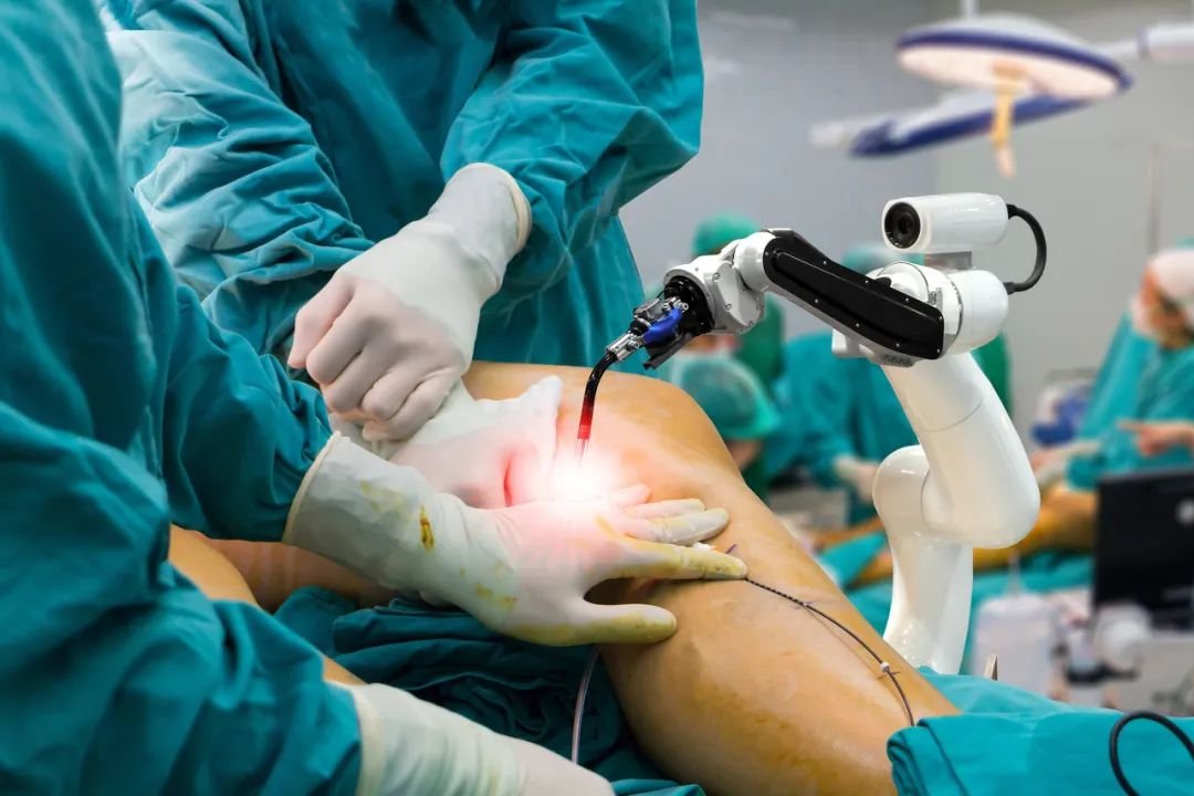 Robotic knee surgery Nagpur