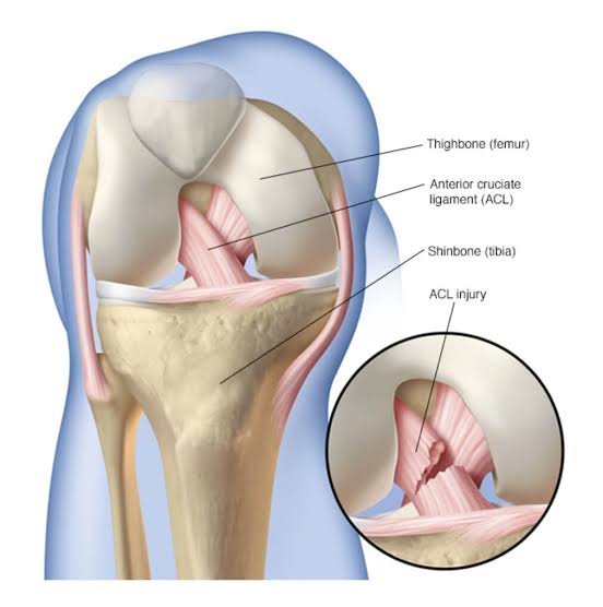 Acl ligament treatment Yavatmal