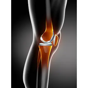 Advanced knee replacement surgery Nagpur