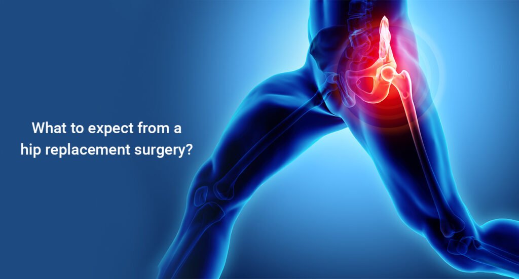 Best hip replacement surgeon in nagpur