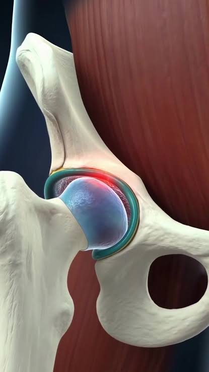 Hip Joint In Nagpur