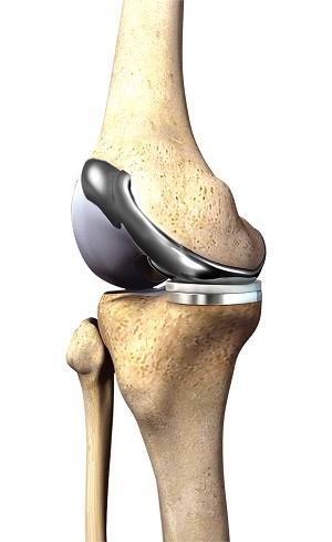 Knee Specialist In Nagpur