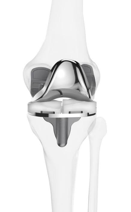 Knee replacement Hoshangabad