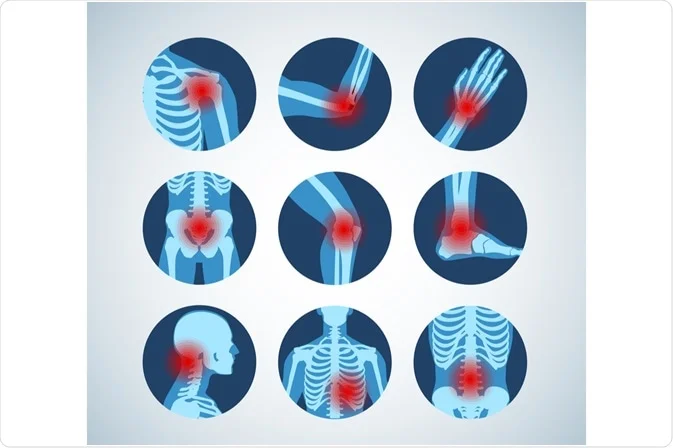 Rheumatologist nagpur