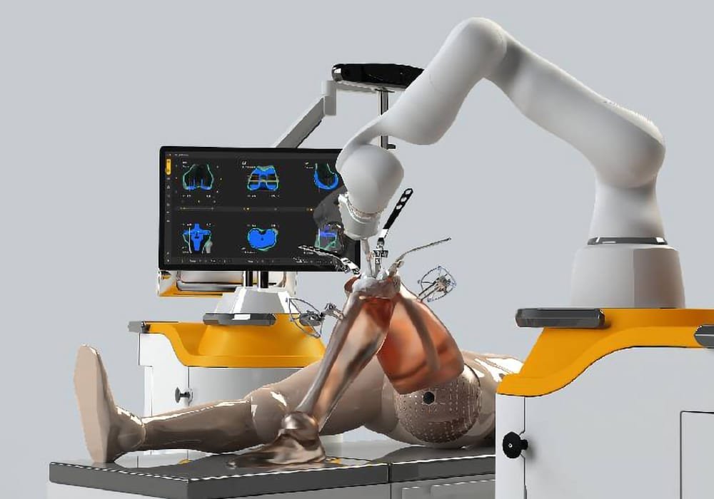Robotic assisted joint replacement Nagpur 