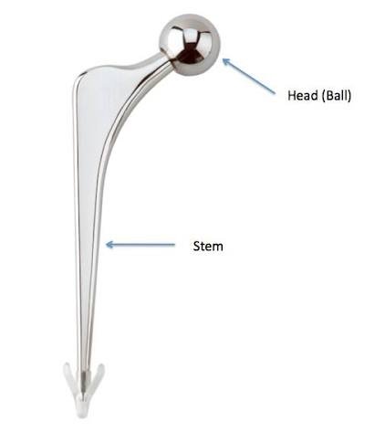 Robotic hip replacement Nagpur