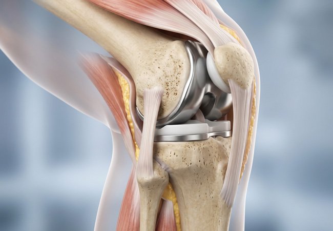 Robotic knee surgery Nagpur